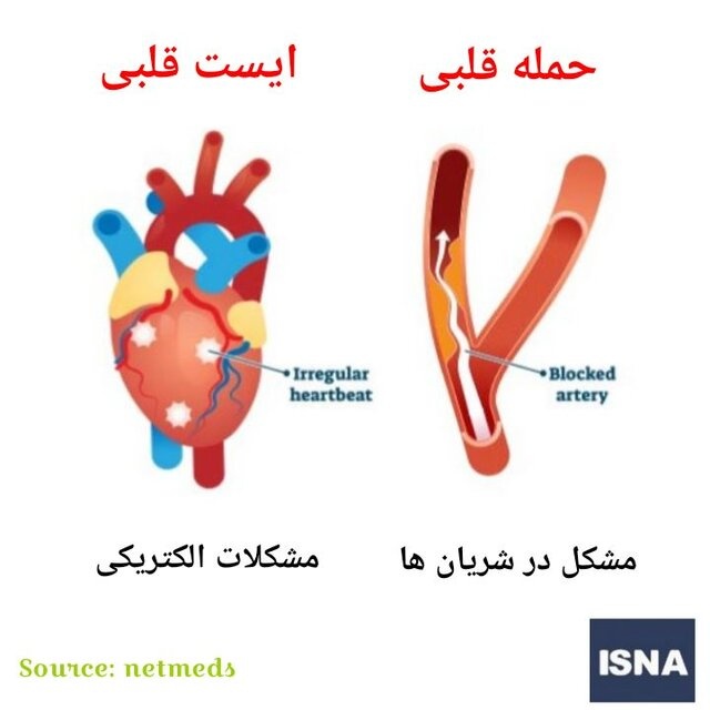 چه عاملی باعث ایست قلبی می‌شود؟