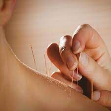 طب سوزنی در منزل