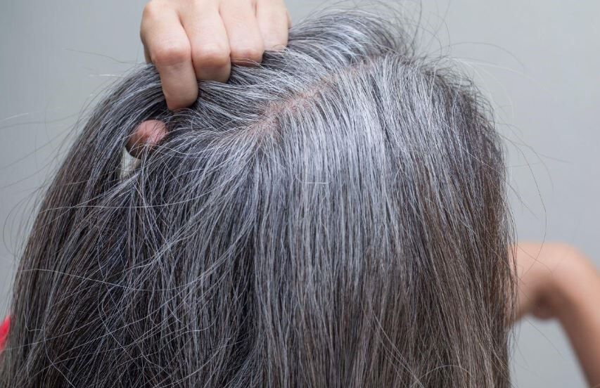 درمان ریزش و سفیدی مو در طب سنتی + فیلم