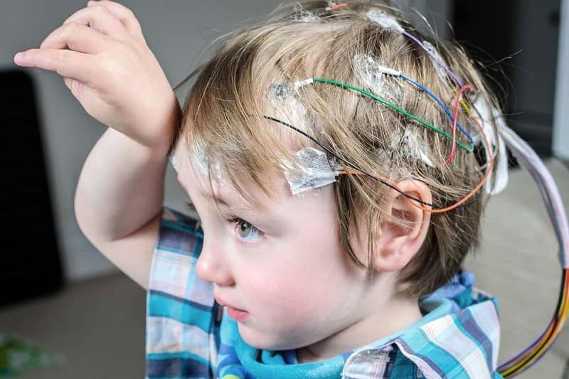 چه زمانی از متخصص مغز و اعصاب کودکان مشاوره بگیریم؟