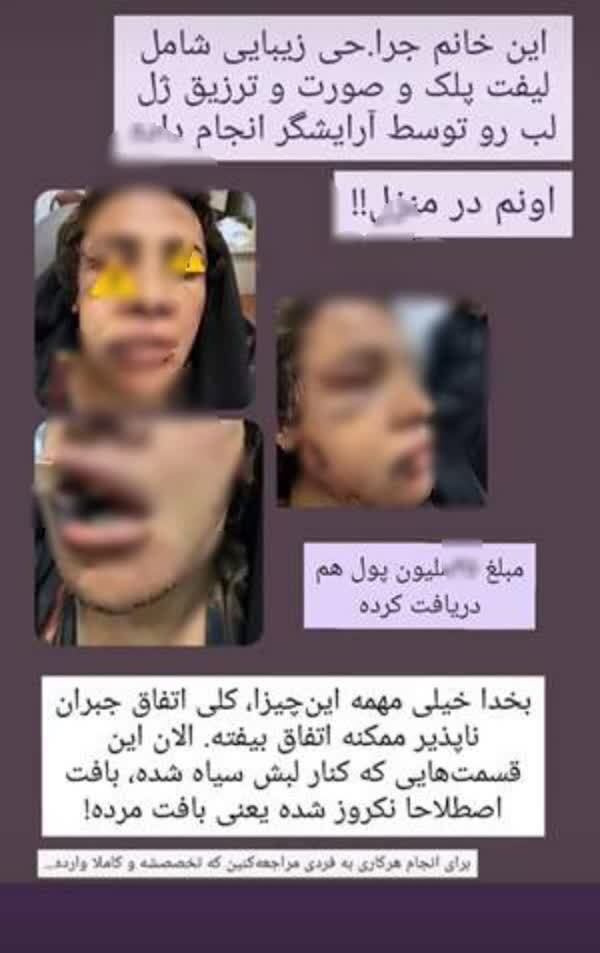 وقتی آرایشگران پزشک زیبایی میشوند!