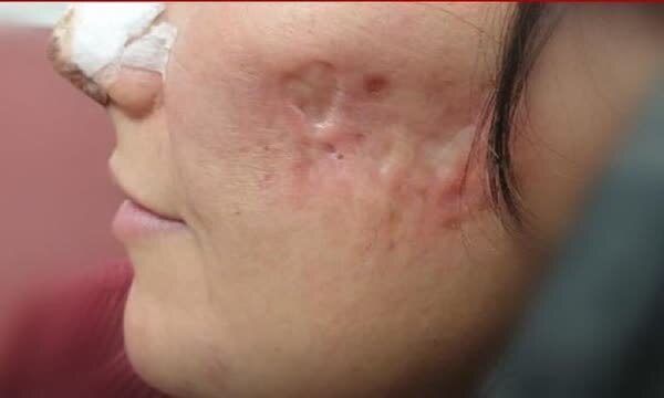 وقتی آرایشگران پزشک زیبایی میشوند!