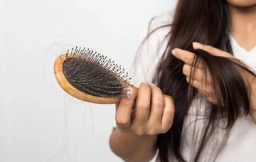 ۶ مورد از اصلی ترین دلایل ریزش مو را بشناسید