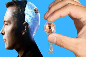 اختلال در عملکرد اولین تراشۀ کاشتهشده در مغز