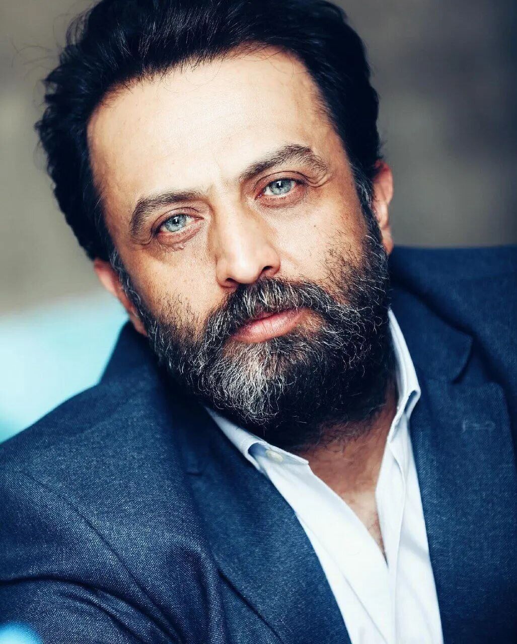 چهره بازیگر یوزارسیف بعد از ۱۶سال از این رو به آن رو شد! + عکس