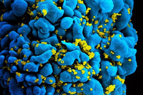 UCLA scientists find cancer immunotherapy drug may be useful against HIV