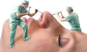 جراحی بینی با تضمین نقص عضو!