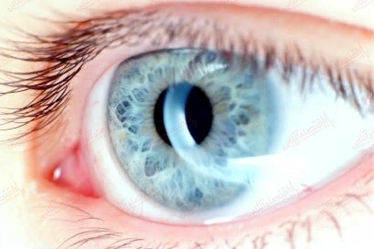 آیا رنگ چشم همیشه تغییر می‌ کند؟ 