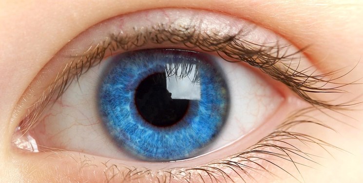 خطرات استفاده از لنز زیبایی در چشم ها
