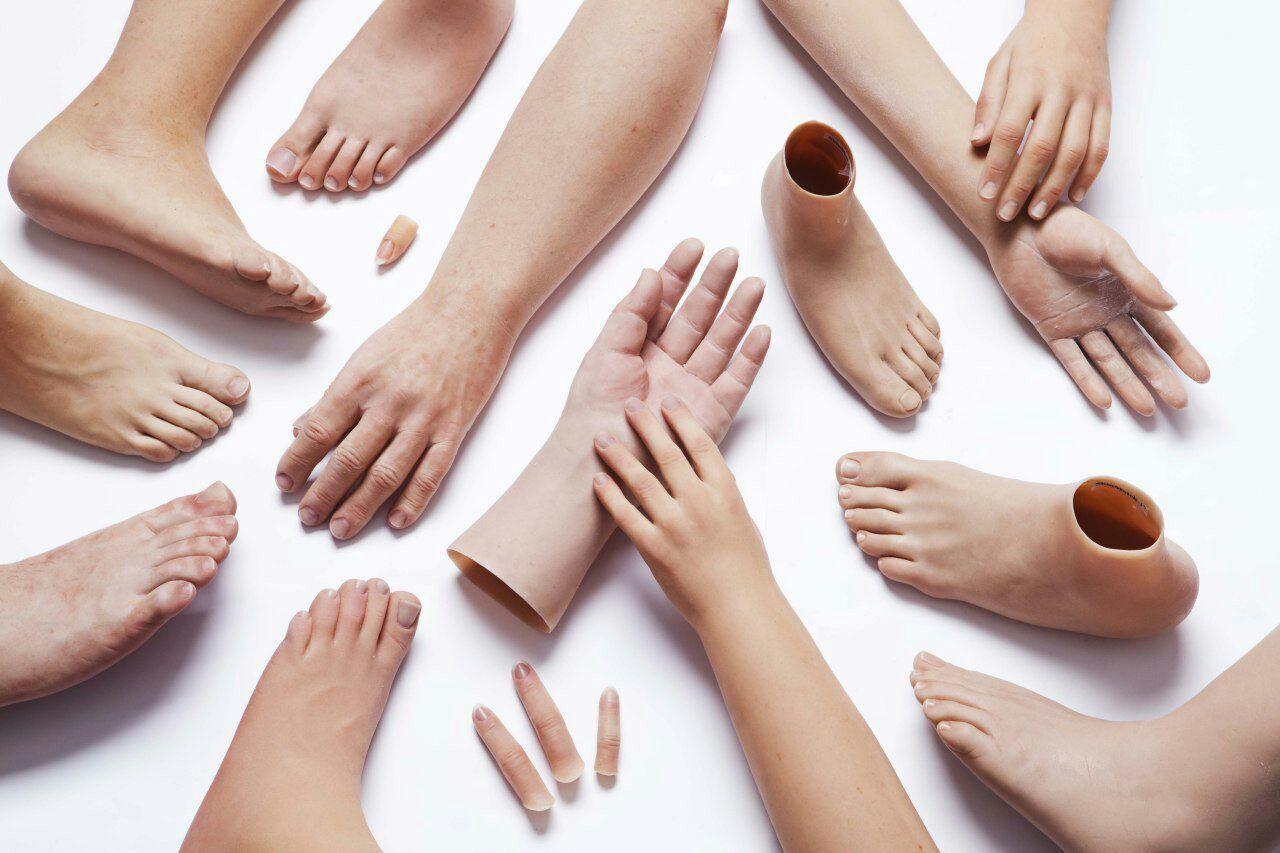 پروتز سیلیکونی (انگشتان) دست و پا: عامل زیبایی و اعتماد به نفس