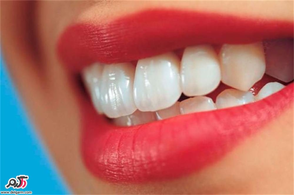 ۱۲ مسکن طبیعی درد دندان