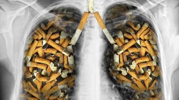 سیگاری ها و خطر ابتلا به ۱۲ نوع سرطان