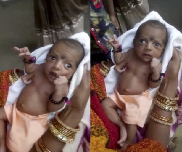 دختری با سه دست در هند متولد شد +عکس