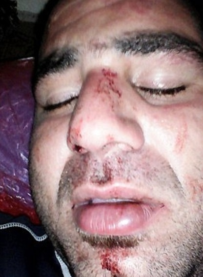 حمله پلیس مهاجرت گینه‎‏نو به دو مهاجر ایرانی +عکس