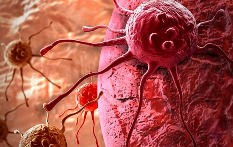تشخیص تومورهای سرطانی با کمک نانو ذرات
