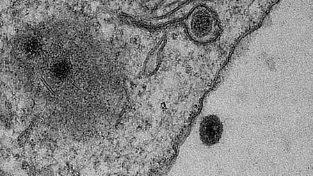 ویروس جدیدی در برزیل کشف شد
