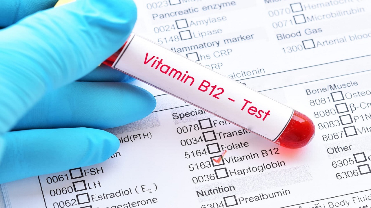 خطرات کمبود ویتامین B۱۲ برای بدن