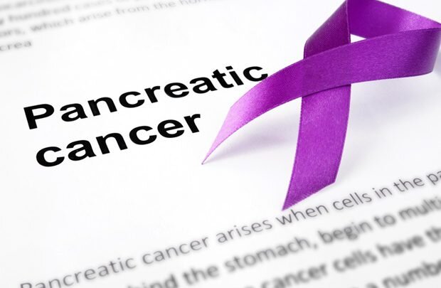 علایم جدید مرتبط با سرطان لوزالمعده شناسایی شد