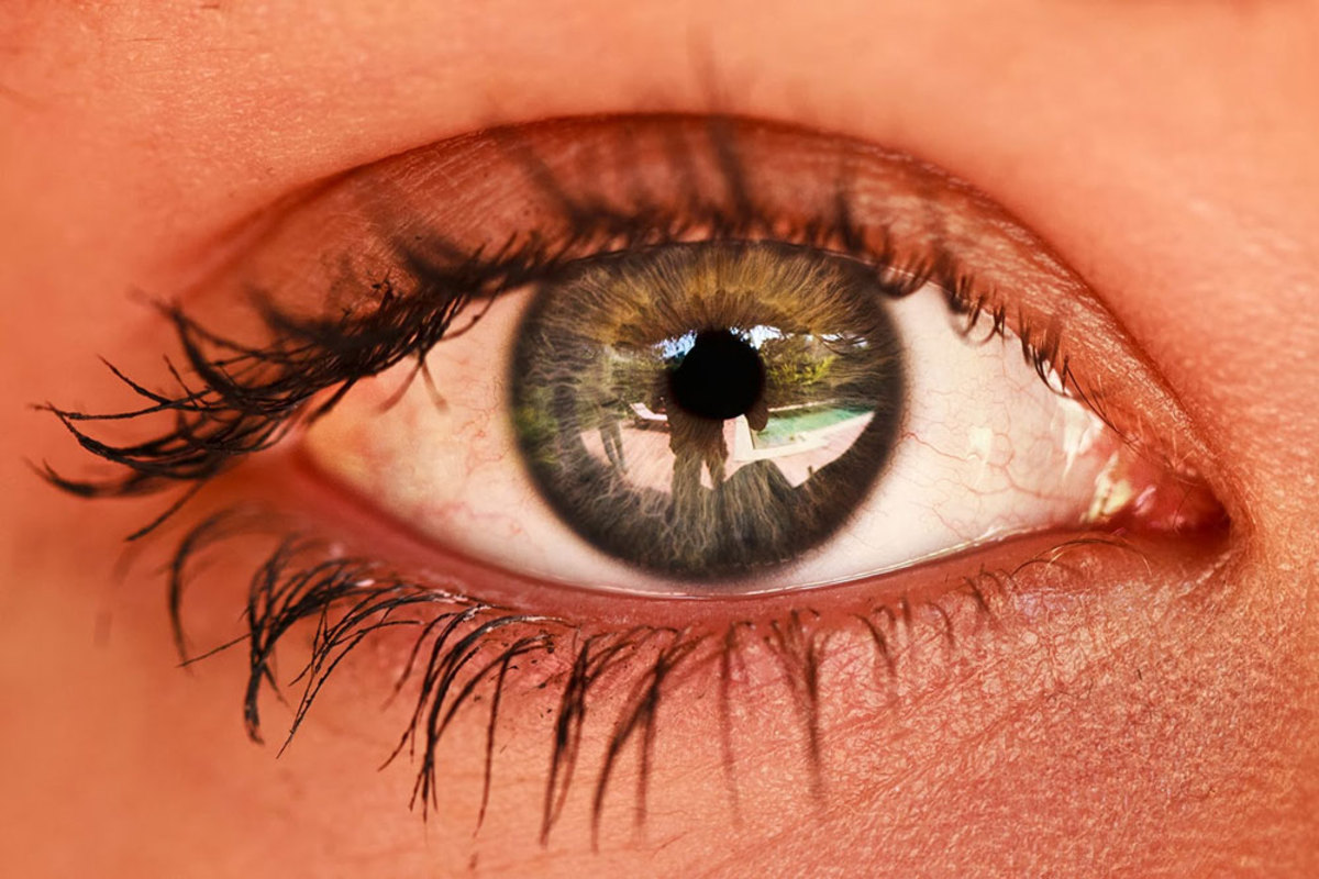 زردی چشم چه وقت  خطرناک می شود؟