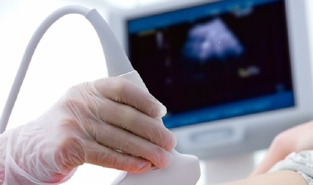 چرا سونوگرافی قبل از تولد ضروری است؟ 