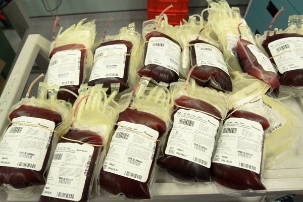 افزایش احتمال لختگی خون در گروه های خونی A و B