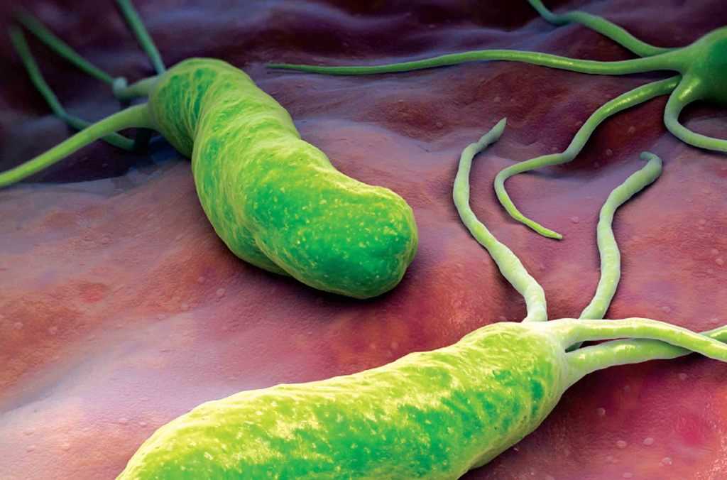 باکتری خطرناک معده که هیچ علامتی ندارد! + عکس
