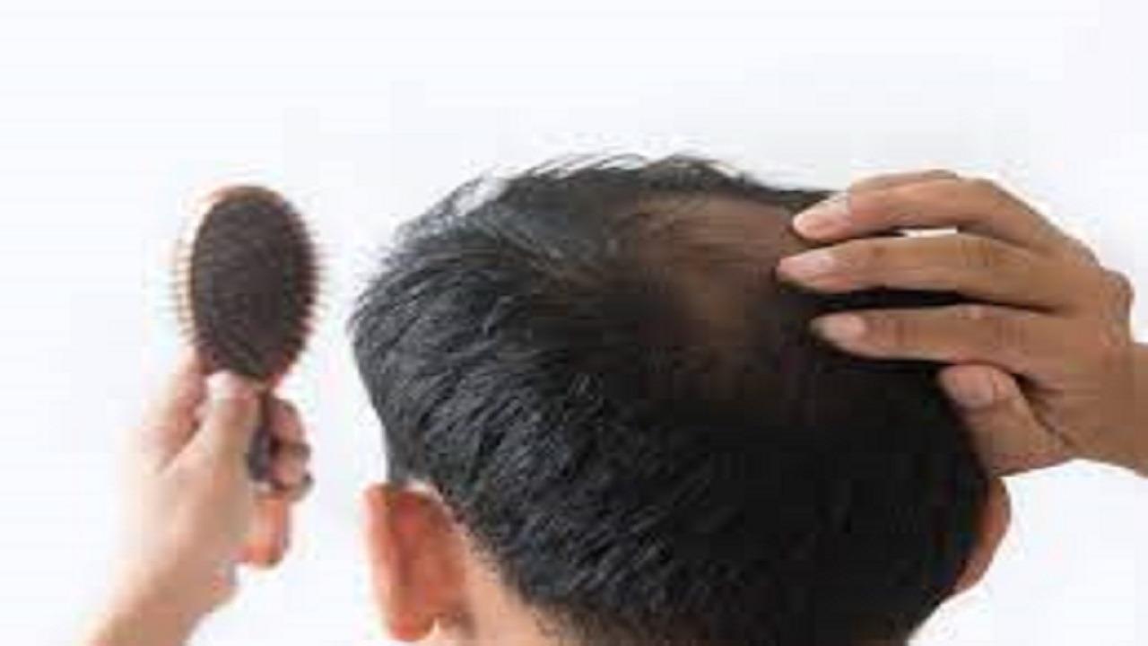 راهی که می تواند ریزش مو را درمان کند / طاسی درمان می شود؟