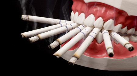  دخانیات در کمین سلامتی دهان و دندان