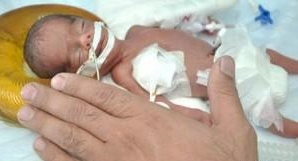 تولد نوزادی به اندازه کف دست +عکس