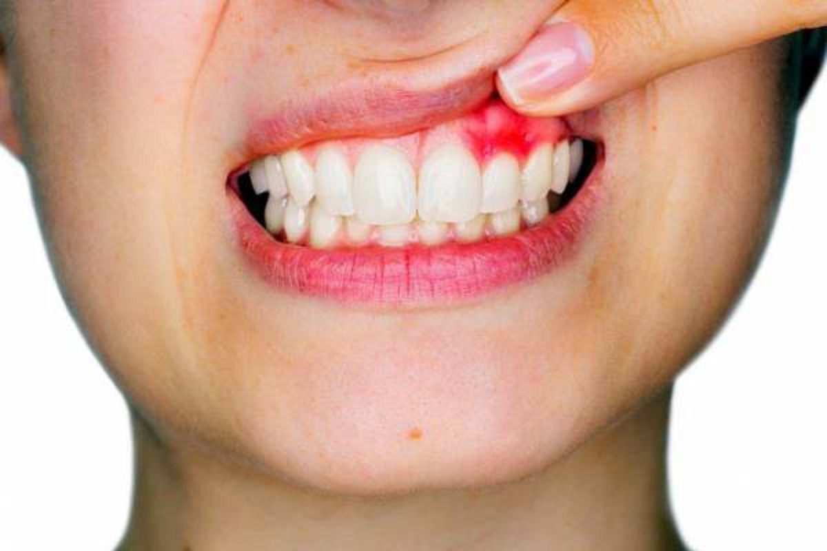 روشی برای درمان دندان‌ درد در شب