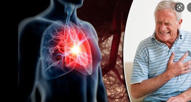 هورمون (کورتیزول) استرس خطر سکته قلبی را چند برابر می کند