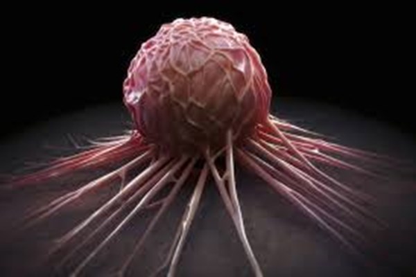 عامل پیشروی سرطان سینه چیست؟