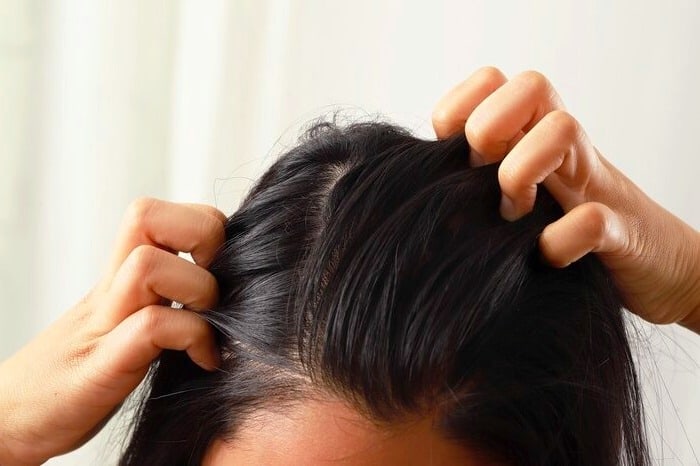 روشی برای توقف ریزش موی تیروئیدی