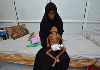 شرایط بد اقتصادی در یمن +عکس