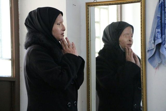 زن اسیدپاش به قصاص و پرداخت دیه محکوم شد +عکس