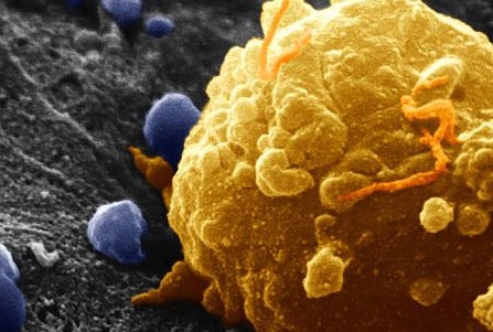 کشف ۷ عامل سرطان‌زای جدید 