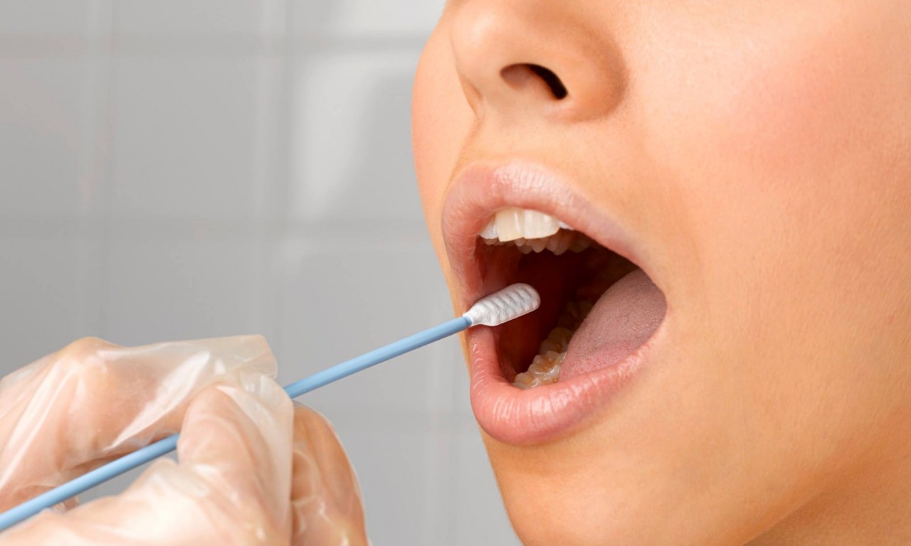  مهم ترین علامت سرطان دهان چیست؟ 
