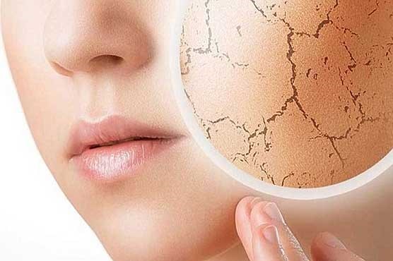 ۷ درمان طبیعی برای خشکی پوست