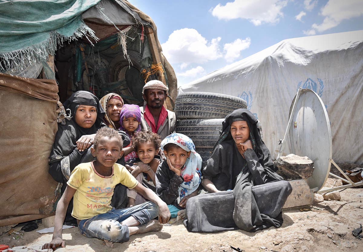 سازمان ملل: یمن بدترین شرایط انسانی روی زمین را دارد