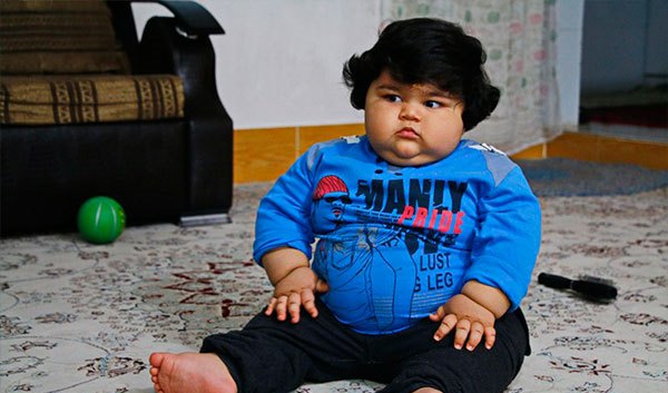 شیوع چاقی در کودکان ایرانی ۲برابر شده است