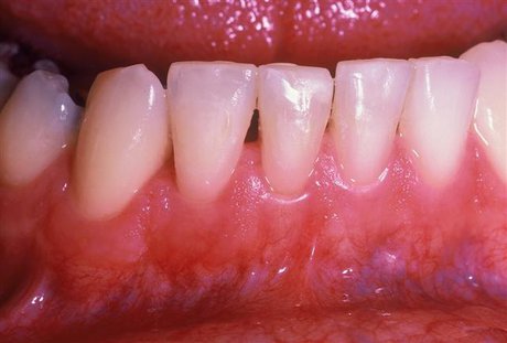  این ۶ راه را برای سلامتی دهان و دندان را جدی بگیرید! 