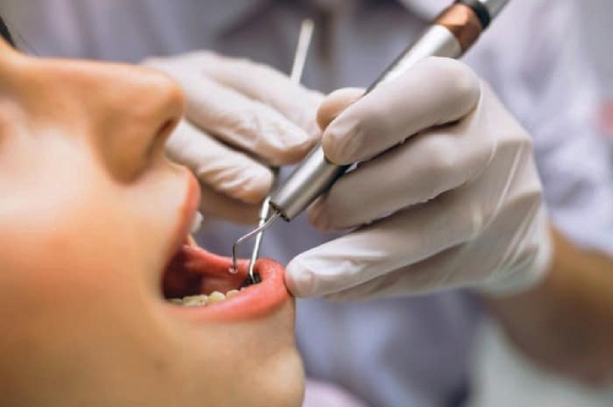دندان عقل چه مشکلاتی برای سلامت لثه ایجاد می کند؟