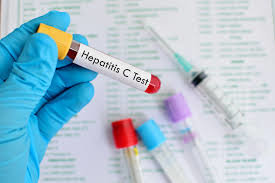 نیمی از معتادان تزریقی هپاتیت c دارند