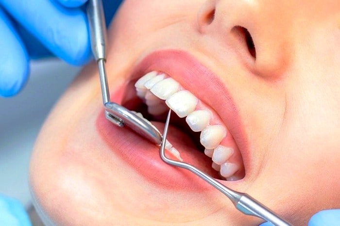 علت زرد شدن دندان ها چیست؟