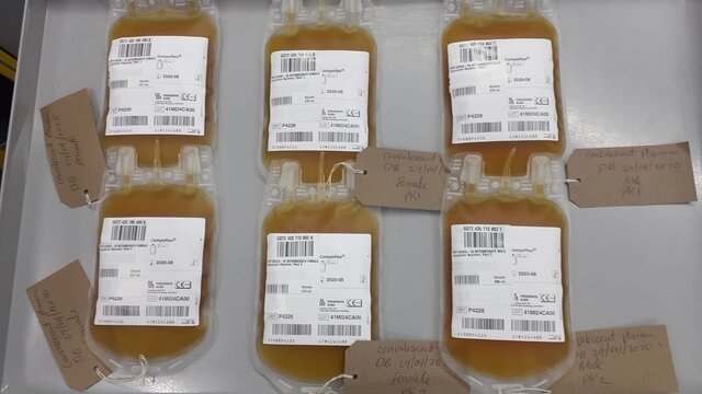 تزریق پلاسمای خون نجات یافتگان کرونا به بیماران در انگلیس