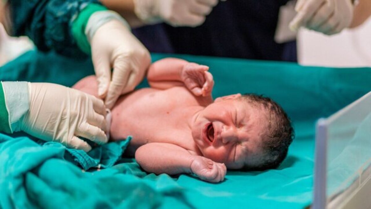 تولد یک نوزاد دختر با دم ۶ سانتی متری + عکس