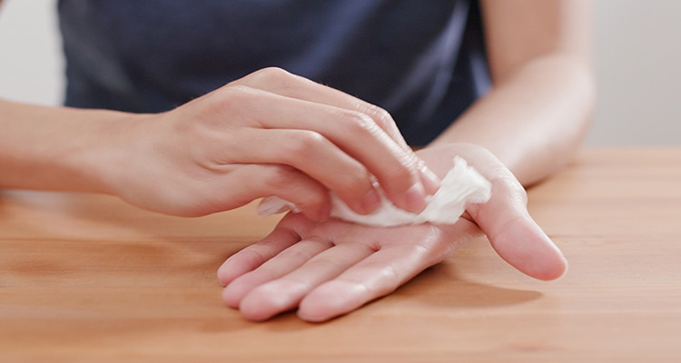 درمان موثر "تعریق کف دست" چیست؟