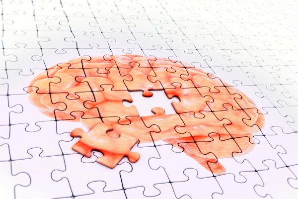 پلاک‌های مغزی قبل از سایر علائم آلزایمر بروز می‌کنند