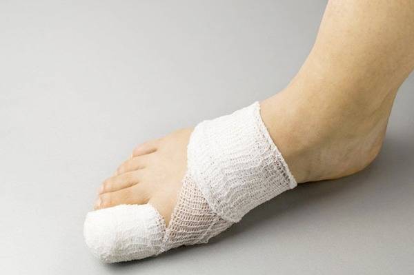 علائم شکستگی انگشت پا و درمان خانگی گیاهی آن / بوعلی سینا با شکستگی انگشت پا چه می کرد؟