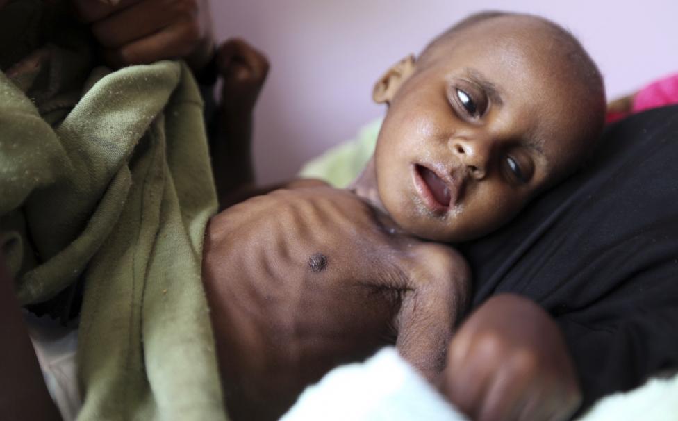 خطر مرگ در کمین ۱۱ میلیون کودک یمنی
